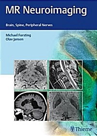 MR Neuroimaging: Brain, Spine, Peripheral Nerves (Hardcover)