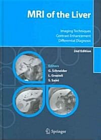 MRI of the Liver: Imaging Techniques, Contrast Enhancement, Differential Diagnosis (Hardcover, 2)
