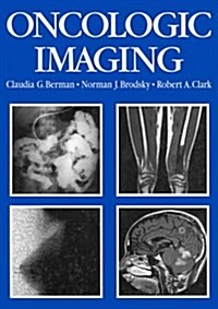 Oncologic Imaging (Hardcover)