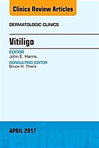 Vitiligo, an Issue of Dermatologic Clinics: Volume 35-2 (Hardcover)
