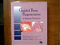 [중고] Guided Bone Regeneration in Implant Dentistry (Hardcover)