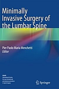 Minimally Invasive Surgery of the Lumbar Spine (Paperback)
