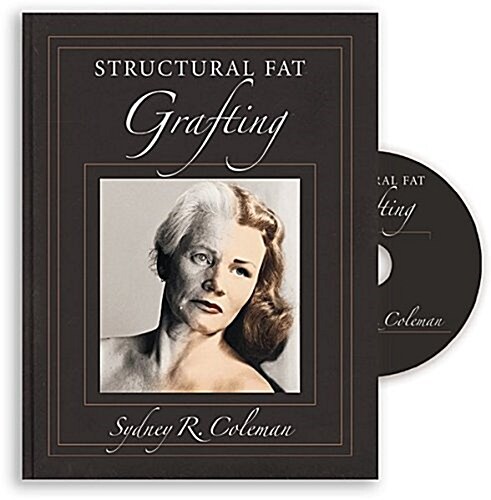 Structural Fat Grafting (Hardcover)