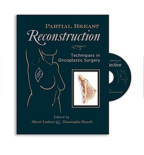 Partial Breast Reconstruction: Techniques in Oncoplastic Surgery (Hardcover)