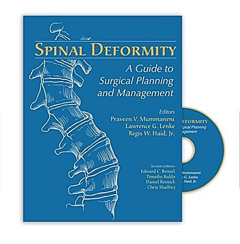 Spinal Deformity: A Guide to Surgical Planning and Management (Hardcover)