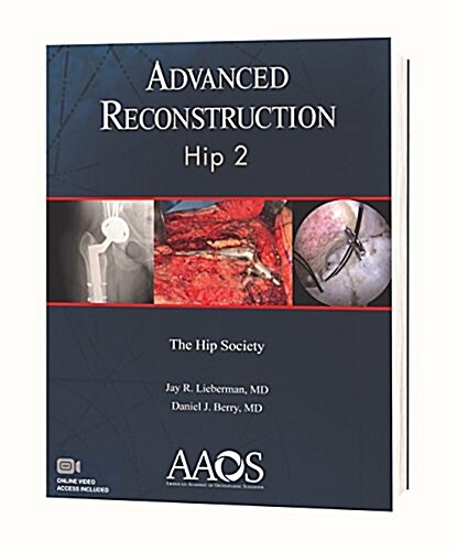 Advanced Reconstruction Hip (Paperback)