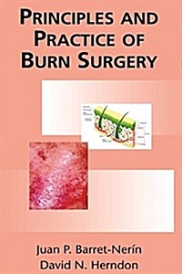 Principles and Practice of Burn Surgery (Hardcover)