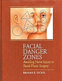 Facial Danger Zones: Avoiding Nerve Injury in Facial Plastic Surgery (Hardcover, 2)