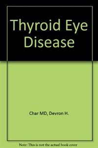 Thyroid eye disease