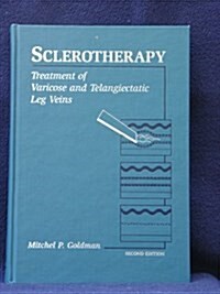 Sclerotherapy (Hardcover, 2nd, Subsequent)