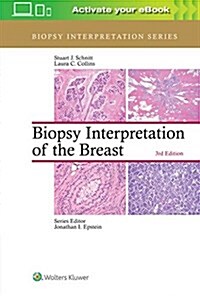Biopsy Interpretation of the Breast (Hardcover)