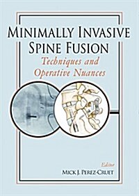 Minimally Invasive Spine Fusion: Techniques and Operative Nuances (Hardcover)