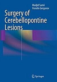 Surgery of Cerebellopontine Lesions (Paperback, Softcover Repri)
