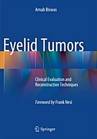 Eyelid Tumors: Clinical Evaluation and Reconstruction Techniques (Paperback, Softcover Repri)