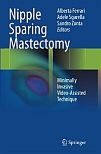 Nipple Sparing Mastectomy: Minimally Invasive Video-Assisted Technique (Paperback, Softcover Repri)