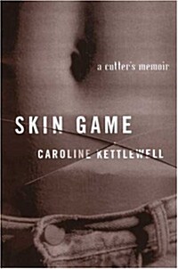 Skin Game: A Memoir (Paperback)