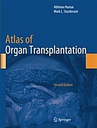 Atlas of Organ Transplantation (Paperback, Softcover reprint of the original 2nd ed. 2015)