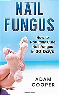 Nail Fungus: How to Naturally Cure Nail Fungus in 30 Days: Natural Remedies, Homeopathy for Toenail Fungus (Paperback)