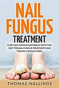 Nail Fungus Treatment: Cure Nail Fungus Naturally with This Fast Toenail Fungus Treatment and Toenail Fungus Cures (Paperback)