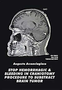 Stop Hemorrhagic & Bleeding in Craniotomy Procedure to Substract Brain Tumor (Hardcover)