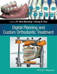 Digital planning and custom orthodontic treatment