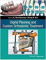 Digital Planning and Custom Orthodontic Treatment (Paperback)