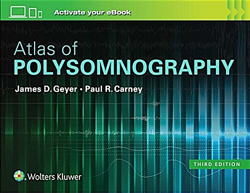 Atlas of Polysomnography (Hardcover)