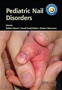 Pediatric Nail Disorders (Hardcover)