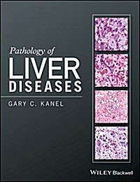 Pathology of Liver Diseases (Hardcover)