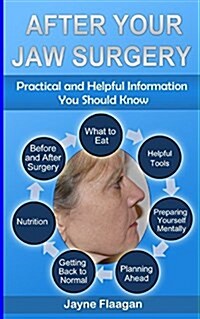 After Your Jaw Surgery: Practical and Helpful Information You Should Know (Paperback)