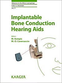Implantable Bone Conduction Hearing AIDS (Hardcover)