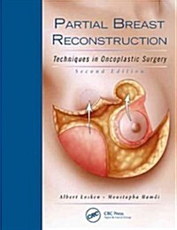 Partial Breast Reconstruction: Techniques in Oncoplastic Surgery (Hardcover, 2)