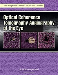 Optical Coherence Tomography Angiography of the Eye: Oct Angiography (Paperback)