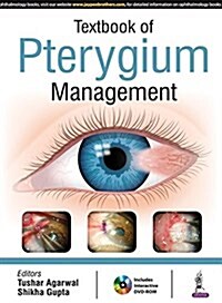 Textbook of Pterygium Management (Paperback)