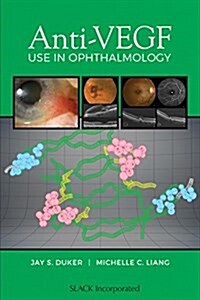 Anti-vegf Use in Ophthalmology (Paperback)
