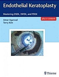 Endothelial Keratoplasty: Mastering Dsek, Dmek, and Pdek (Hardcover)