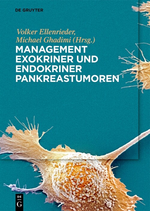 Management Exokriner Und Endokriner Pankreastumoren (Hardcover)